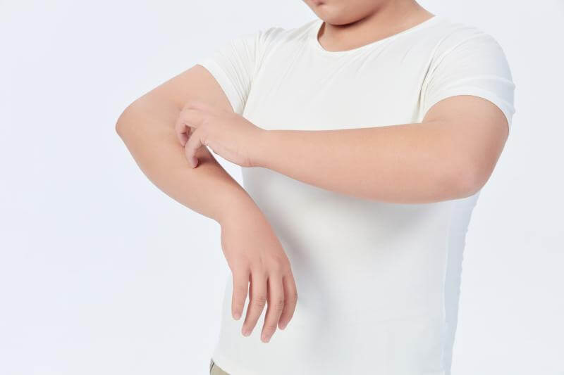 孩子出现这些症状？可能是甲醛中毒！-图2